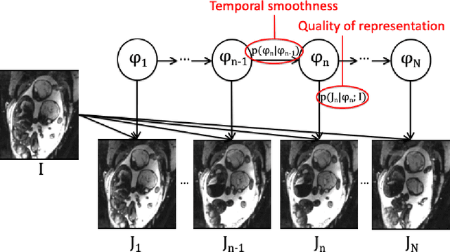 Figure 2 for Temporal Registration in Application to In-utero MRI Time Series