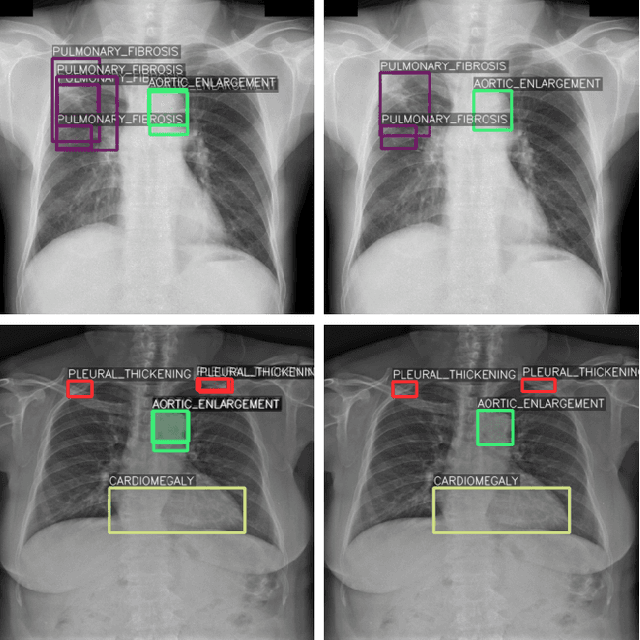 Figure 1 for Self-Supervised Learning as a Means To Reduce the Need for Labeled Data in Medical Image Analysis