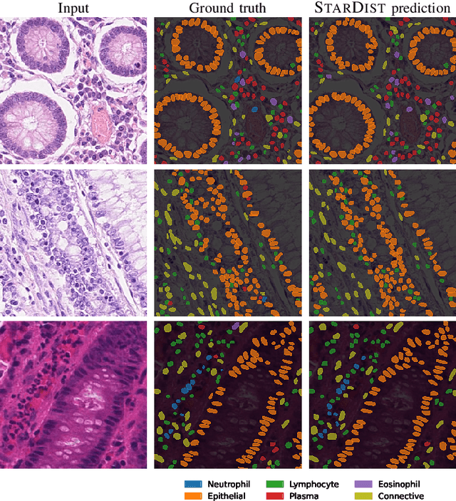 Figure 1 for Nuclei instance segmentation and classification in histopathology images with StarDist