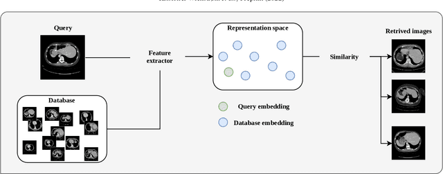 Figure 1 for A clinically motivated self-supervised approach for content-based image retrieval of CT liver images