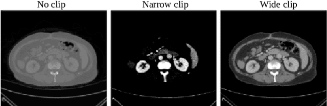 Figure 3 for A clinically motivated self-supervised approach for content-based image retrieval of CT liver images