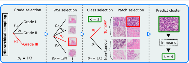 Figure 3 for Hybrid guiding: A multi-resolution refinement approach for semantic segmentation of gigapixel histopathological images
