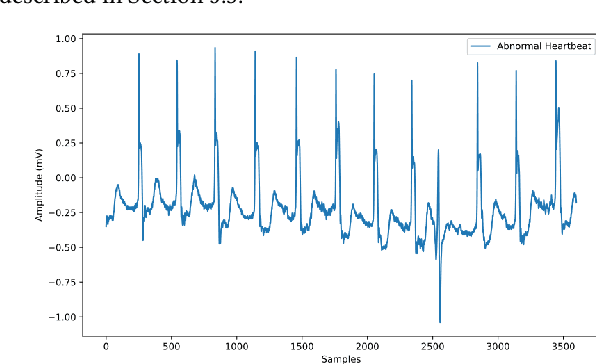 Figure 1 for Evolving SimGANs to Improve Abnormal Electrocardiogram Classification