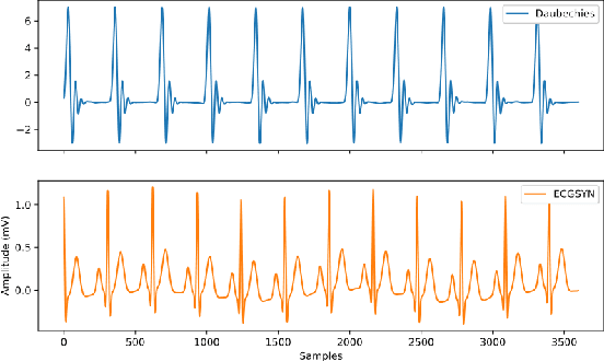 Figure 3 for Evolving SimGANs to Improve Abnormal Electrocardiogram Classification