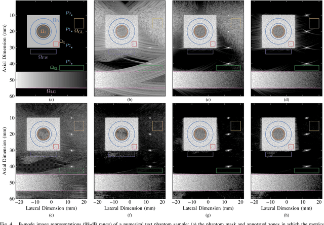 Figure 4 for CNN-Based Image Reconstruction Method for Ultrafast Ultrasound Imaging