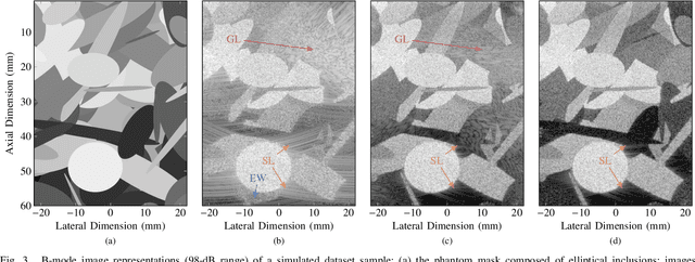 Figure 3 for CNN-Based Image Reconstruction Method for Ultrafast Ultrasound Imaging