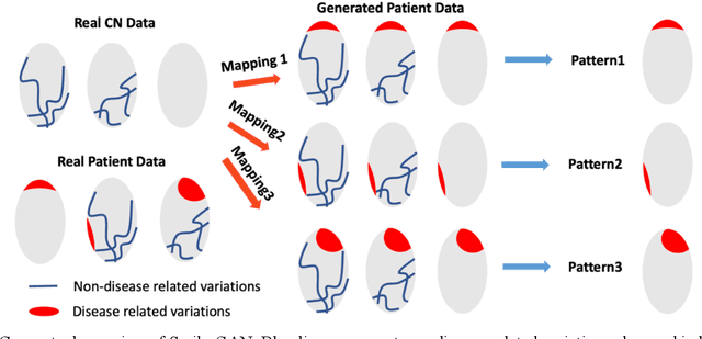 Figure 1 for Disentangling brain heterogeneity via semi-supervised deep-learning and MRI: dimensional representations of Alzheimer's Disease