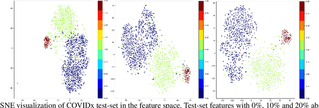 Figure 1 for Reducing Risk and Uncertainty of Deep Neural Networks on Diagnosing COVID-19 Infection