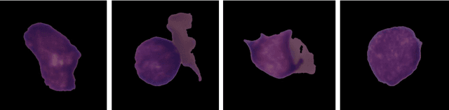 Figure 4 for Acute Lymphoblastic Leukemia Detection from Microscopic Images Using Weighted Ensemble of Convolutional Neural Networks