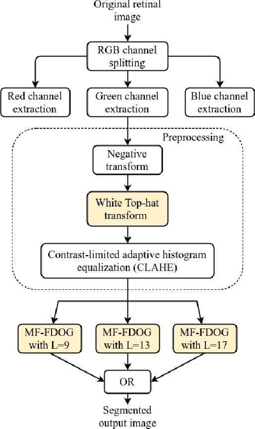 Figure 4 for Blood Vessel Detection using Modified Multiscale MF-FDOG Filters for Diabetic Retinopathy