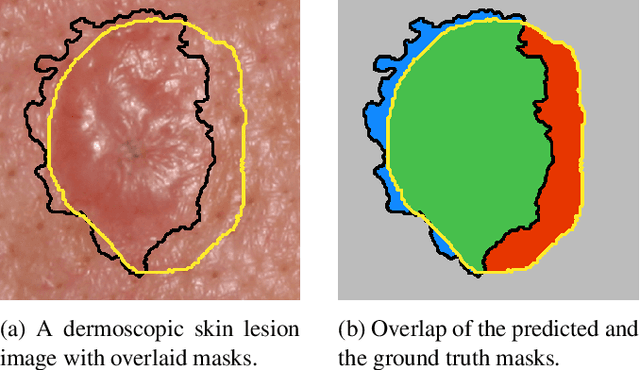 Figure 1 for Matthews Correlation Coefficient Loss for Deep Convolutional Networks: Application to Skin Lesion Segmentation