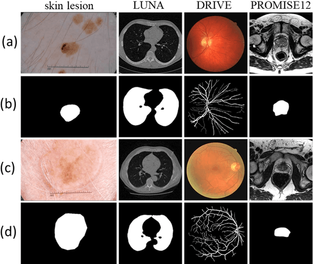 Figure 2 for U-Net Based Architecture for an Improved Multiresolution Segmentation in Medical Images