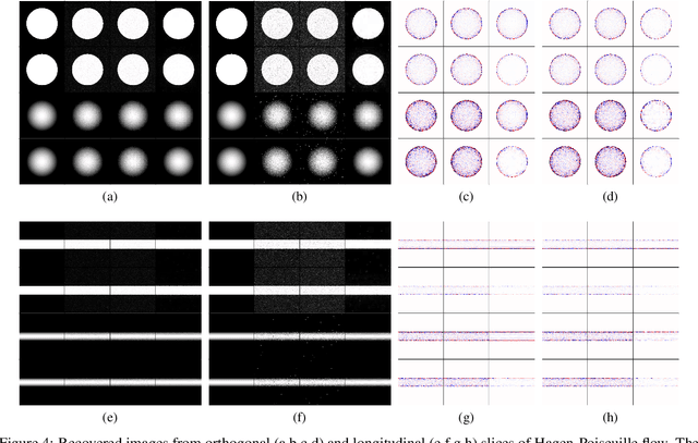 Figure 4 for An analysis of reconstruction noise from undersampled 4D flow MRI