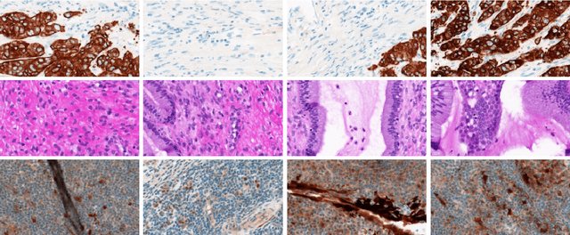 Figure 2 for A Comparative Study of CNN, BoVW and LBP for Classification of Histopathological Images