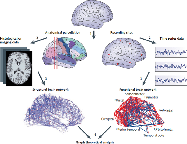 Figure 3 for A novel framework for automatic detection of Autism: A study on Corpus Callosum and Intracranial Brain Volume