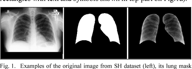 Figure 1 for Chest X-Ray Analysis of Tuberculosis by Deep Learning with Segmentation and Augmentation
