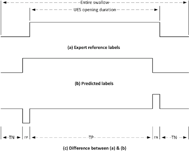 Figure 3 for Upper Esophageal Sphincter Opening Segmentation with Convolutional Recurrent Neural Networks in High Resolution Cervical Auscultation