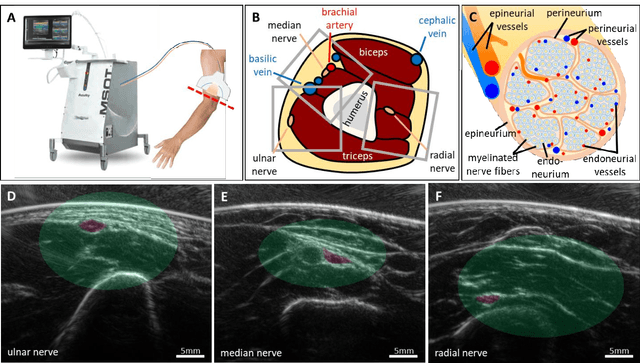 Figure 1 for Spotlight on nerves: Portable multispectral optoacoustic imaging of peripheral nerve vascularization and morphology