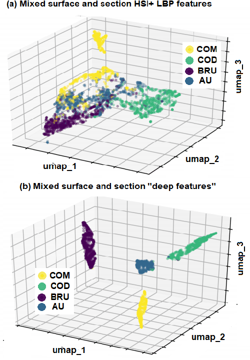 Figure 2 for Assessing deep learning methods for the identification of kidney stones in endoscopic images