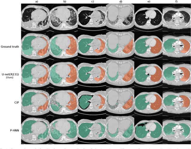 Figure 1 for Automatic lung segmentation in routine imaging is a data diversity problem, not a methodology problem