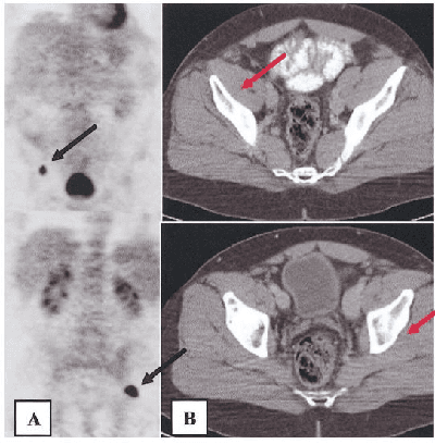 Figure 2 for Radiological images and machine learning: trends, perspectives, and prospects