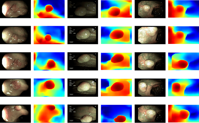 Figure 3 for Extraction of Key-frames of Endoscopic Videos by using Depth Information