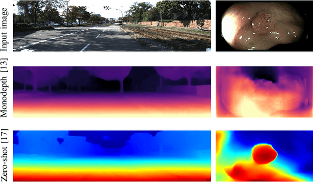 Figure 4 for Extraction of Key-frames of Endoscopic Videos by using Depth Information