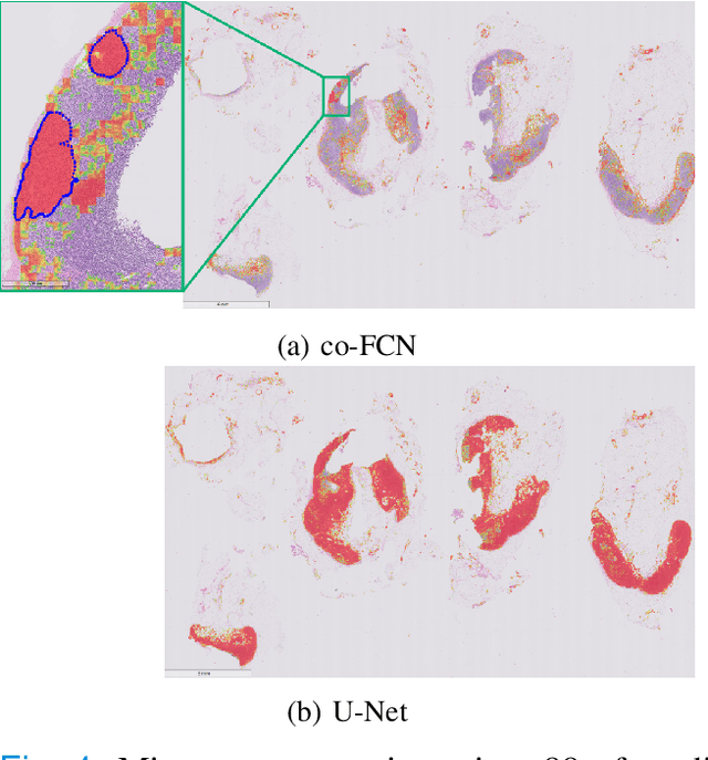 Figure 4 for Conditional Deep Convolutional Neural Networks for Improving the Automated Screening of Histopathological Images
