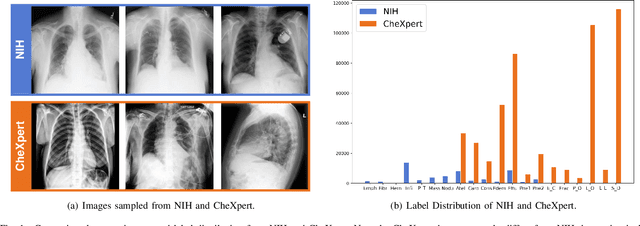 Figure 1 for Deep Mining External Imperfect Data for Chest X-ray Disease Screening