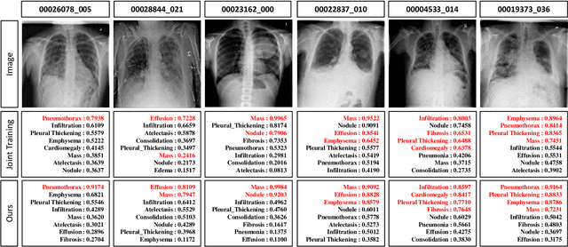 Figure 3 for Deep Mining External Imperfect Data for Chest X-ray Disease Screening