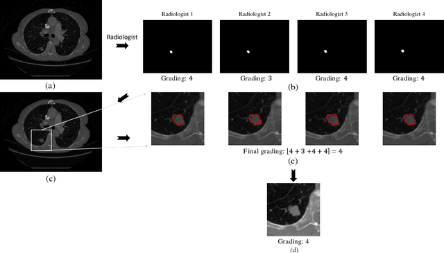 Figure 4 for SISC: End-to-end Interpretable Discovery Radiomics-Driven Lung Cancer Prediction via Stacked Interpretable Sequencing Cells