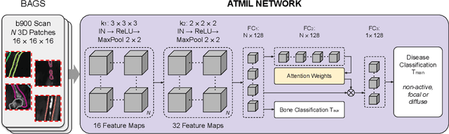 Figure 3 for Multiple Instance Learning with Auxiliary Task Weighting for Multiple Myeloma Classification