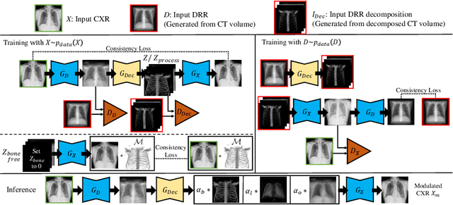 Figure 3 for Encoding CT Anatomy Knowledge for Unpaired Chest X-ray Image Decomposition