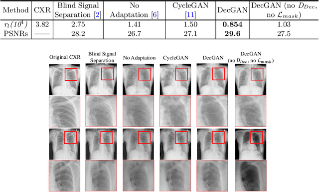 Figure 2 for Encoding CT Anatomy Knowledge for Unpaired Chest X-ray Image Decomposition
