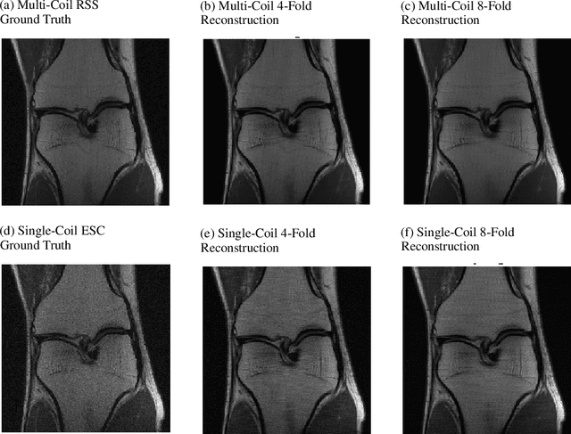 Figure 1 for i-RIM applied to the fastMRI challenge
