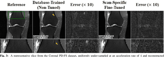 Figure 3 for High-Fidelity Accelerated MRI Reconstruction by Scan-Specific Fine-Tuning of Physics-Based Neural Networks