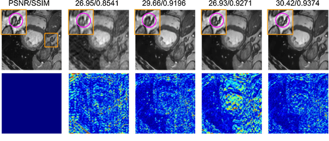 Figure 1 for A deep cascade of ensemble of dual domain networks with gradient-based T1 assistance and perceptual refinement for fast MRI reconstruction