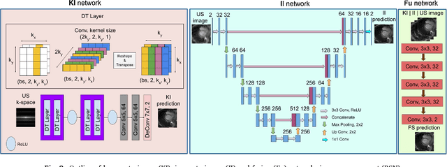 Figure 3 for A deep cascade of ensemble of dual domain networks with gradient-based T1 assistance and perceptual refinement for fast MRI reconstruction