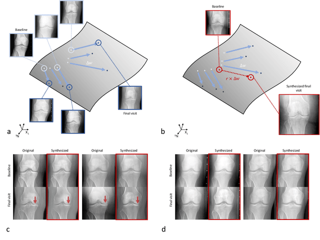 Figure 3 for Predicting Osteoarthritis Progression in Radiographs via Unsupervised Representation Learning