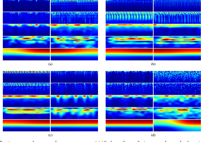 Figure 2 for Fine-grained ECG Classification Based on Deep CNN and Online Decision Fusion