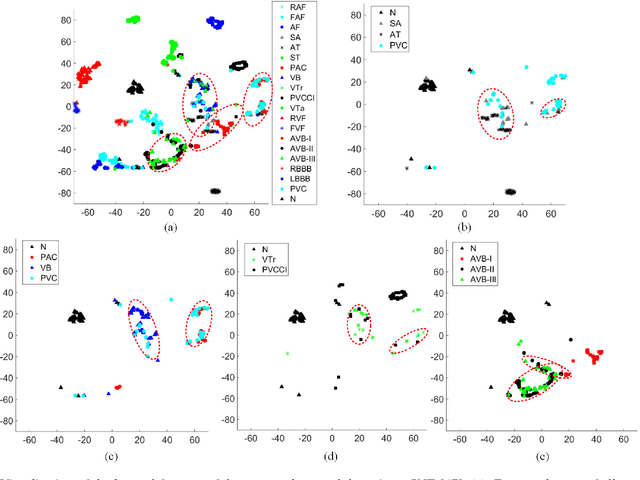 Figure 4 for Fine-grained ECG Classification Based on Deep CNN and Online Decision Fusion