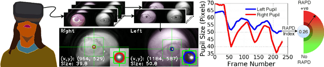 Figure 3 for Automated Pupillary Light Reflex Test on a Portable Platform