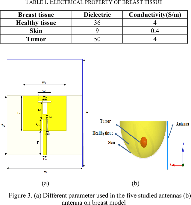 Figure 2 for Circular Antenna Array Design for Breast Cancer Detection