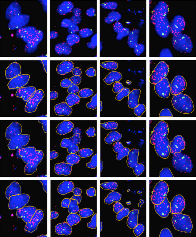 Figure 2 for Clumped Nuclei Segmentation with Adjacent Point Match and Local Shape based Intensity Analysis for Overlapped Nuclei in Fluorescence In-Situ Hybridization Images