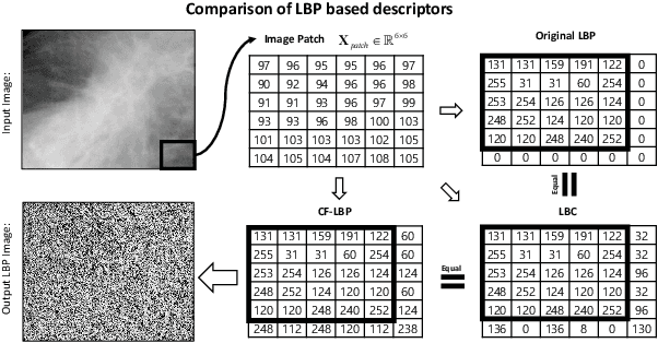 Figure 1 for A Convolution-Free LBP-HOG Descriptor For Mammogram Classification