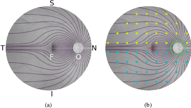 Figure 1 for RetiNerveNet: Using Recursive Deep Learning to Estimate Pointwise 24-2 Visual Field Data based on Retinal Structure