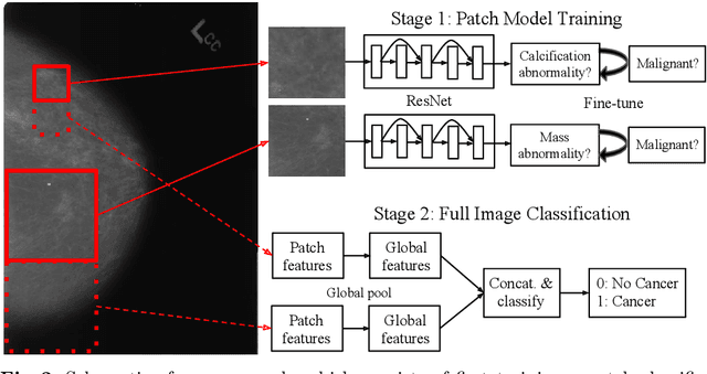 Figure 2 for A Multi-Scale CNN and Curriculum Learning Strategy for Mammogram Classification