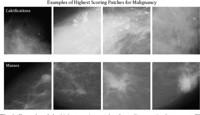 Figure 3 for A Multi-Scale CNN and Curriculum Learning Strategy for Mammogram Classification