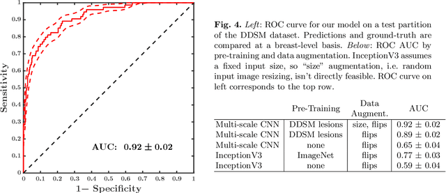 Figure 4 for A Multi-Scale CNN and Curriculum Learning Strategy for Mammogram Classification