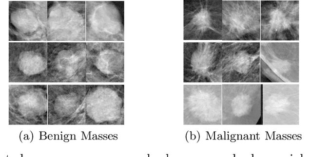 Figure 2 for Signed Laplacian Deep Learning with Adversarial Augmentation for Improved Mammography Diagnosis